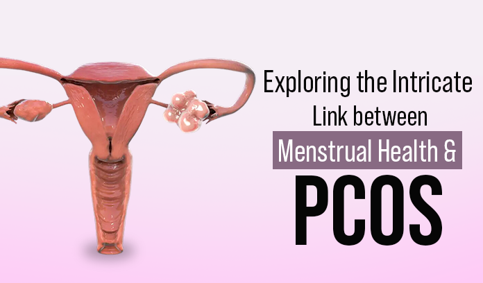 Exploring the Intricate Link between Menstrual Health and PCOS