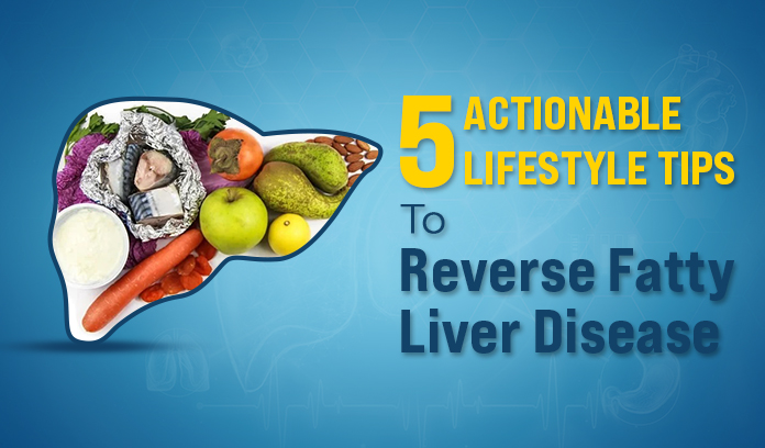 5 Actionable Lifestyle Tips To Reverse Fatty Liver Disease