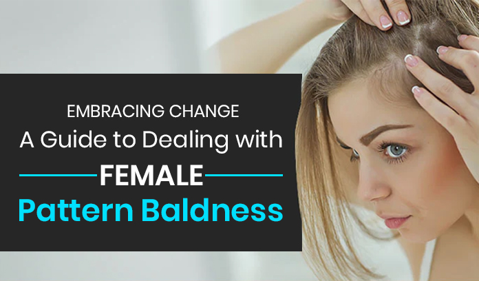 A Guide to Dealing with Female Pattern Baldness