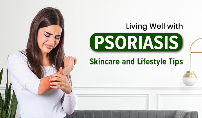 Living Well with Psoriasis: Skincare and Lifestyle Tips